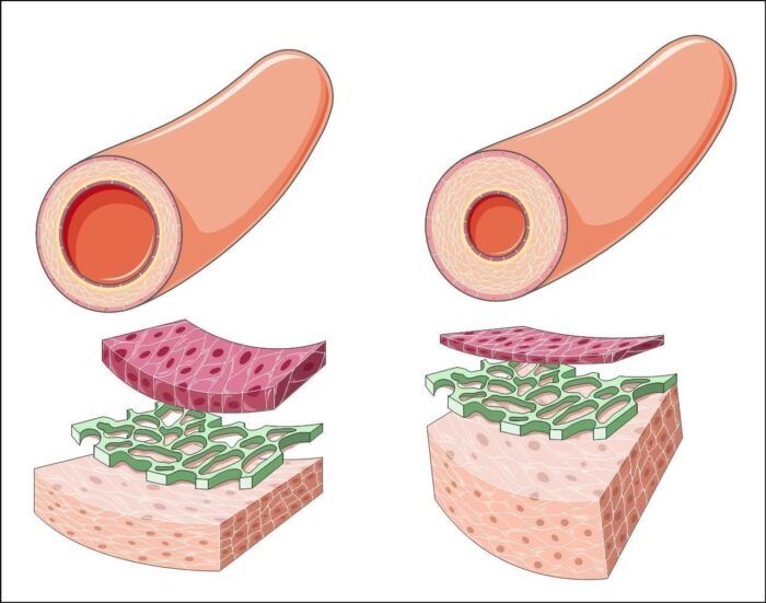 Cómo bajar los triglicéridos: dieta, alcohol, omega-3 y cúrcuma con criterio